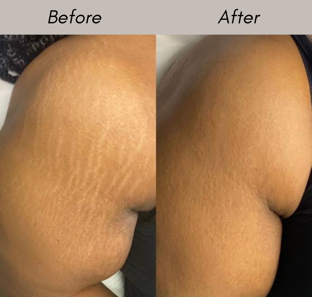 Before After Result 1